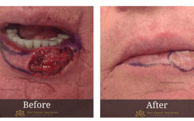We Offer The Best Surgical Care Solutions To Get Your Skin Restored