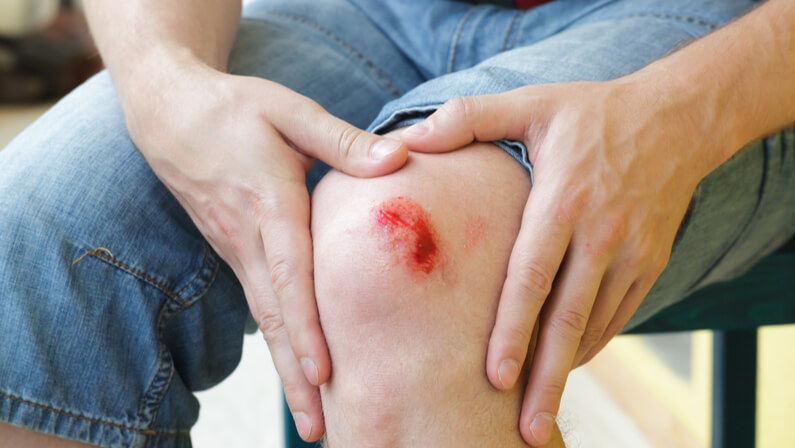 Person with wound in his knee